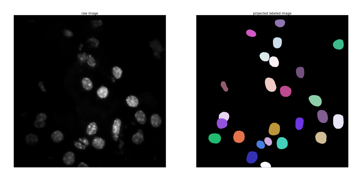 ../../../_images/getting_started_tutorials_notebooks_full_pyHiM_run_26_1.png